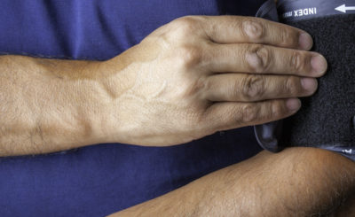 Person with a blood pressure cuff on their arm